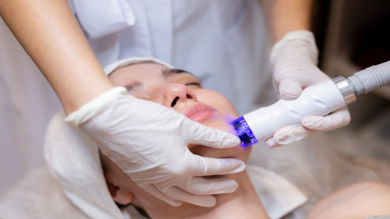 Understanding the Basics of Laser Hair Removal